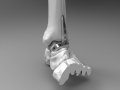 thumbs Ankle plate 3 Medical